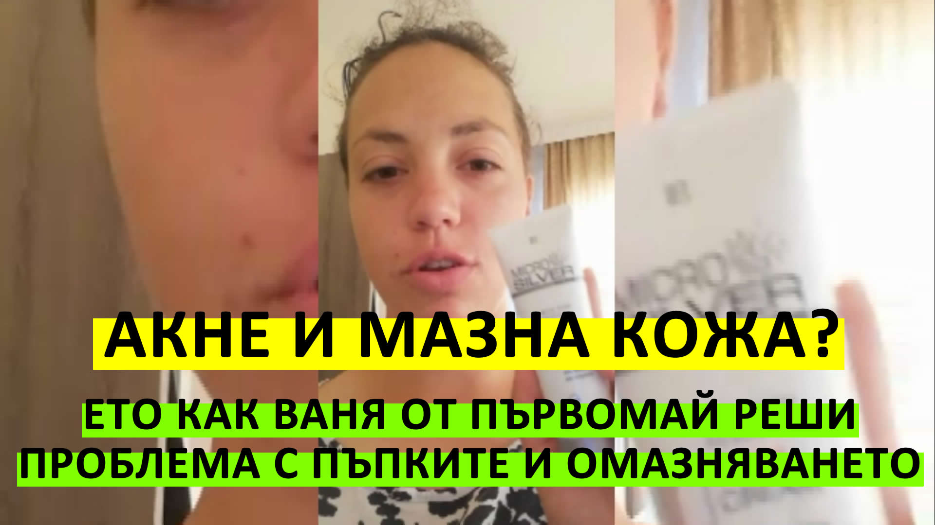 Акне и мазна кожа? Ето Как Ваня от Първомай реши проблема си с пъпките и омазняването на лицето!